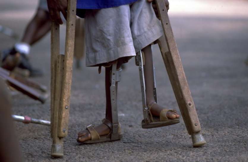 Polio in Pakistan पाकिस्तान में बढ़ रहा पोलियो का आतंक, एक साल में सामने आए 72 मामले
