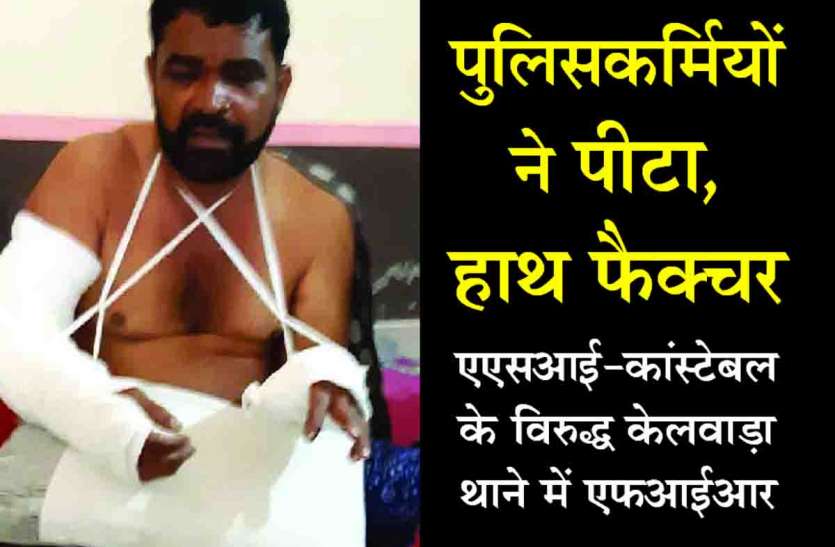 Rajsamand,rajsamand latest news,Rajsamand police,rajsamand latest hindi news,Kelwara News,Kelwara police station incharge,rajsamand latest hindi news rajsamand,Latest News rajsamand,Latest hindi news rajsamand,Crime News rajsamand, घर में घुसकर पुलिसकर्मियों ने एक व्यक्ति को पीटा, हाथ फैक्चर