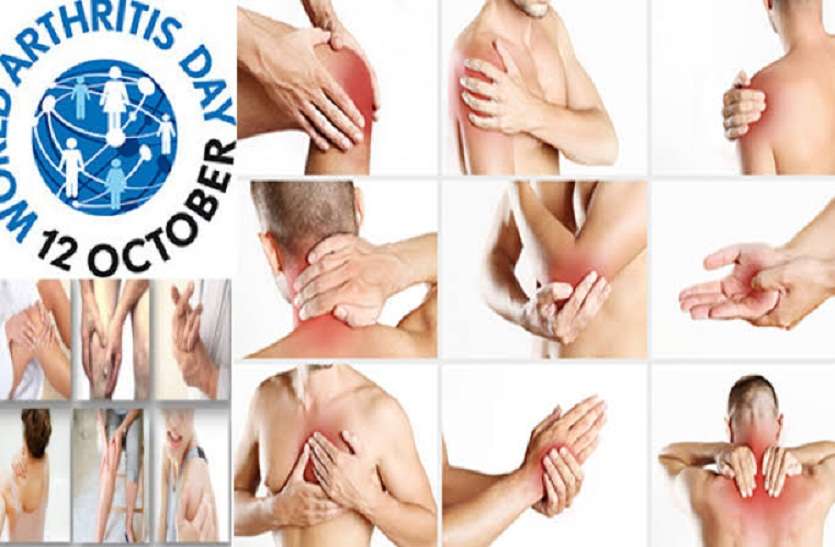 World Arthritis Day: जाने क्या है गठिया रोग, लक्षण और उपचार World Arthritis Day: जाने क्या है गठिया रोग, लक्षण और उपचार