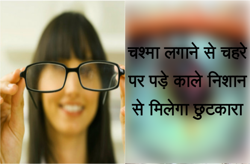 health news चश्मा लगाने से चहरे पर पड़ गया है काला निशान, छुटकारा दिलाएगा ये असरदार तरीका