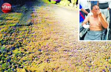 Road Accident: Husband and wife injured by falling off bike in banswar बांसवाड़ा : दाहोद रोड पर खस्ताहाल सडक़ से निकली कंकरीट में बाइक फिसली, गिरने से पति-पत्नी घायल
