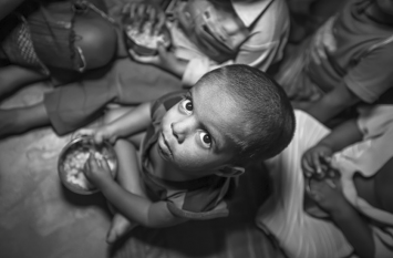 Poor Diets And Food System Damaging children's Health Worldwide Malnutrition: 20 करोड़ से ज्यादा बच्चे कुपाेषण के शिकार : यूनिसेफ