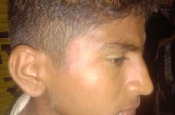 Attack on taking animals to Nandishala, three injured पशुओं को नंदीशाला ले जाने पर हमला, पिता-पुत्र सहित तीन घायल