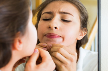 Pimples: Causes, treatment, and prevention Pimples: बार-बार छूने से और ज्यादा निकलते हैं पिंपल्स, फैलते हैं इनके बैक्टीरिया