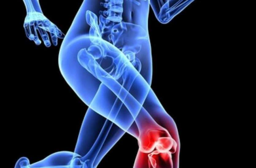 Meniscus Injury घुटने में मेनिसकस की चोट बना सकती है अपंग