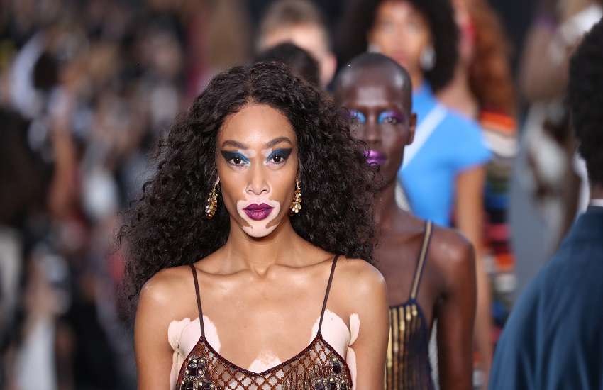 winnie harlow