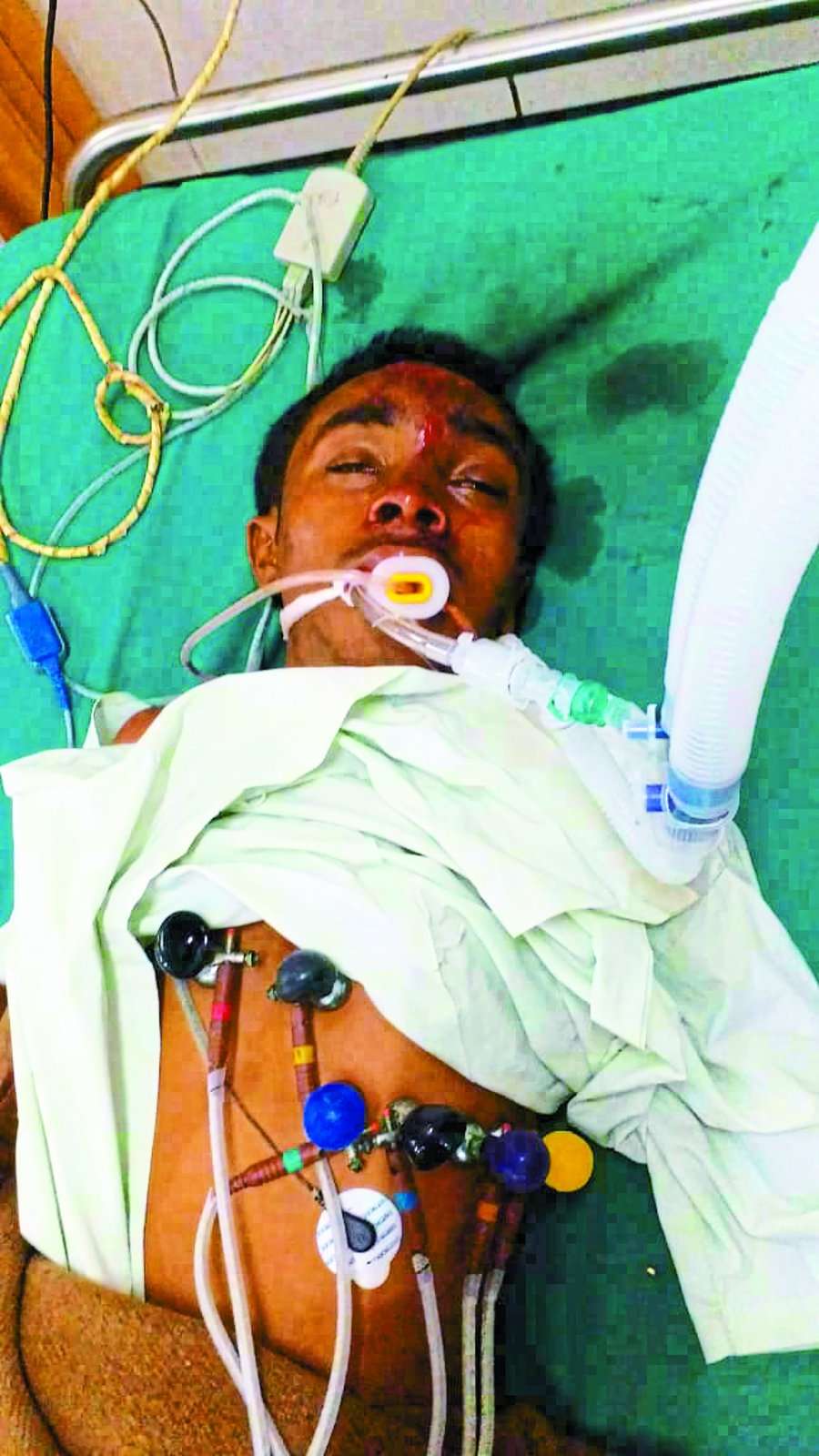 ट्रायल लेने गए बस चालक ने बाइक सवार दो युवकों को कुचला