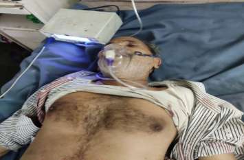 four lakh fifty thousand looted frome monim in gwalior Breaking : SBI बैंक कैंपस में मुनीम को बदमाशों ने गोली मारी, 4.5 लाख लूटकर फरार, देखें वीडियो