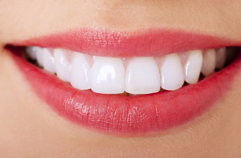 Teeth Clean And Shiny Teeth :- दांतों को साफ और चमकदार बनाने अपनाएं यह तरीके..