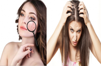 Know the treatment for dry skin, pimples, hair fall and dandruff जानिए रूखी त्वचा, मुंहासों, झाइयों, झड़ते बालों और डैंड्रफ के लिए उपचार