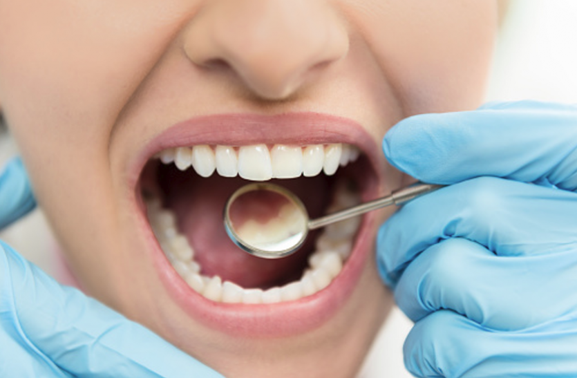 You Can Get New Teeth At Any Age By Dental Implant - डेंटल इंप्लांट से किसी  भी उम्र में पा सकते हैं नया दांत | Patrika News