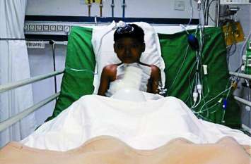 The risk of heart disease in children growing rapidly in Bemetara जिले में तेजी से बढ़ रहा बच्चों में हृदयरोग का खतरा, पांच साल में मिले 295 हृदयरोग पीडि़त बच्चे