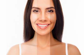 Banana Peel off is beneficial for skin,It is helpful to get Fair Skin सांवली रंगत से गिरता है कॉफिडेंटस तो केले के छिलकों को इन 10 तरीकों से करें इस्तेमाल