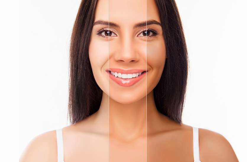 home remedies for glowing skin सांवली रंगत से गिरता है कॉफिडेंटस तो केले के छिलकों को इन 10 तरीकों से करें इस्तेमाल