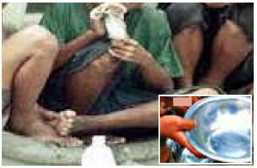 भिक्षावृत्ति और नशा शहर पर कलंक.... भिक्षावृत्ति और नशा शहर पर कलंक....
