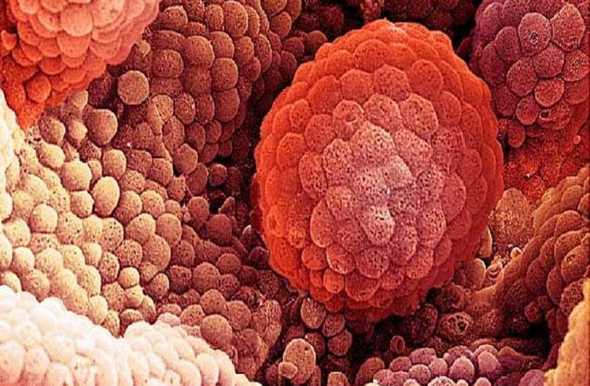 Cancer इन लक्षणों को भूलकर भी न करें इग्नोर, हो सकता है मेटास्टैटिक कैंसर