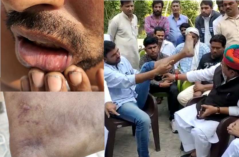 ट्रक चालक ने एंट्री फीस नहीं दी तो पुलिस ने लगाए करंट के झटके, बर्बरता से पीटा ट्रक चालक ने एंट्री फीस नहीं दी तो पुलिस ने लगाए करंट के झटके, बर्बरता से पीटा