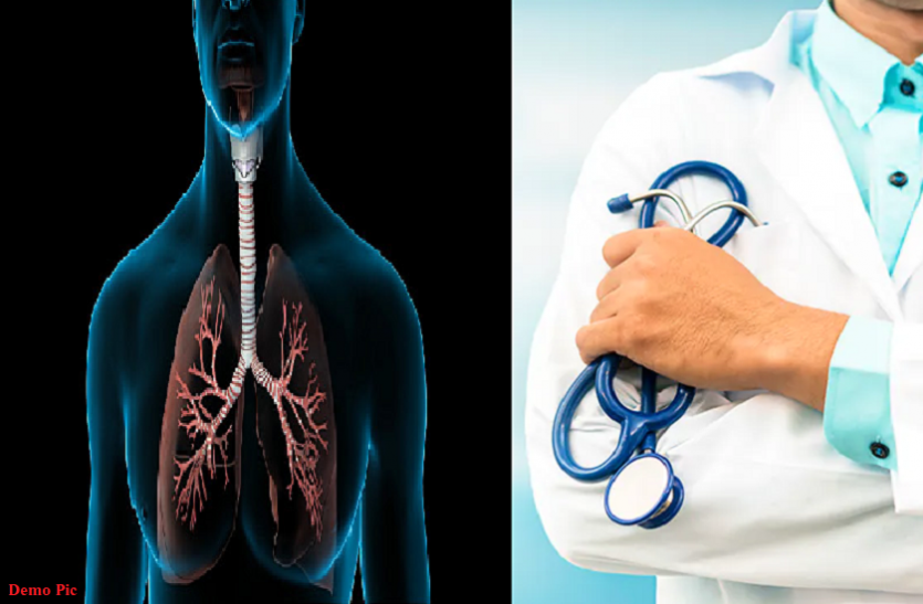 doctor सिगरेट पीने वाले शख्स ने दान किए अपने फेफड़े, डॉक्टरों ने देखा तो बोले...