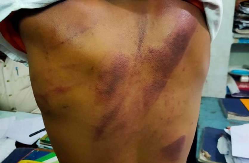 Teenager beaten by a man who entered the house with the intention of m किशोरी के साथ छेड़छाड़ की नीयत से घर में घुसे युवक की हुई पिटाई
