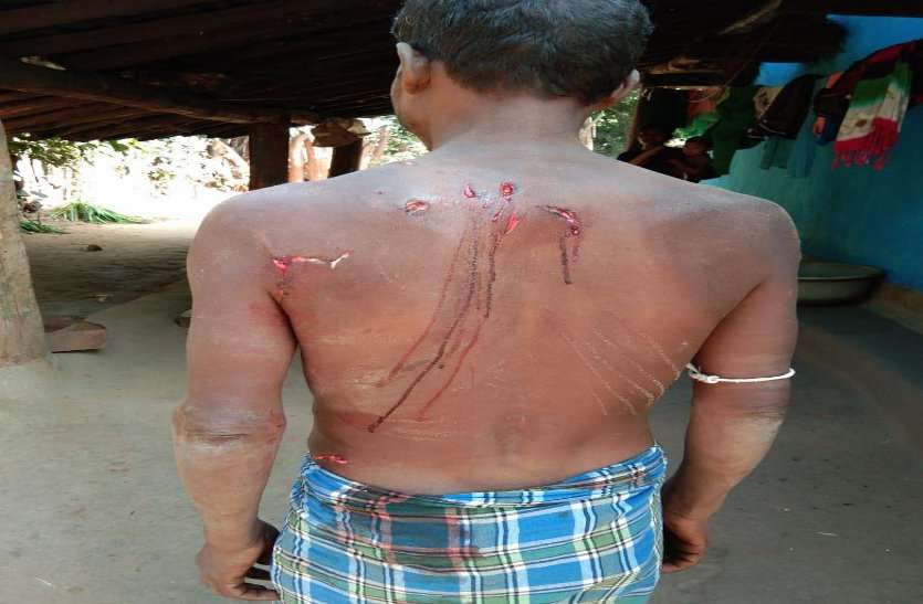 रस्सी बनाने जंगल गए ग्रामीण पर एक साथ तीन भालूओं ने हमला किया और नोंच ली उसकी पीठ, फिर... रस्सी बनाने जंगल गए ग्रामीण पर एक साथ तीन भालूओं ने हमला किया और नोंच ली उसकी पीठ, फिर...