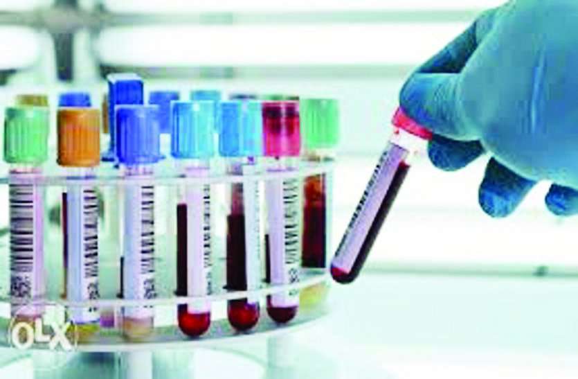 जहरीली गैसों की पहचान के लिए कारगर होगा ये गैस सेंसर, खासकर अमोनिया और एथनॉल की सूक्ष्म स्तर पर होगी पहचान जहरीली गैसों की पहचान के लिए कारगर होगा ये गैस सेंसर, खासकर अमोनिया और एथनॉल की सूक्ष्म स्तर पर होगी पहचान