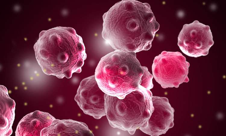 breast-cancer-5.jpg