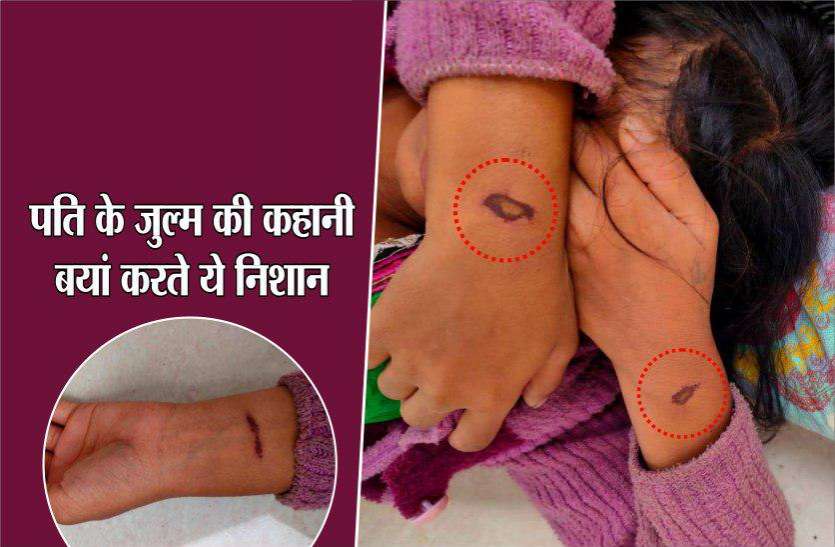 पत्नी को हार-पैर बांध 7 दिन कमरे में पटका, बच्ची को दूध पिलाने के बहाने रस्सी खुलवाकर भागी, सुनाई ये दर्दनाक कहानी पत्नी को हार-पैर बांध 7 दिन कमरे में पटका, बच्ची को दूध पिलाने के बहाने रस्सी खुलवाकर भागी, सुनाई ये दर्दनाक कहानी