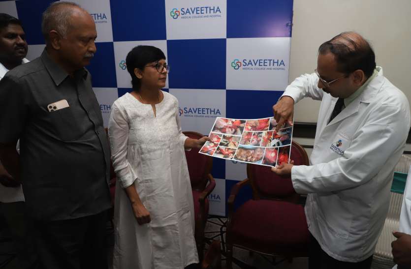 चेन्नई के चिकित्सकों ने महिला के पेट से निकाला 759 सिस्ट, जानिए कितना खतरनाक एवं क्या है सिस्ट चेन्नई के चिकित्सकों ने महिला के पेट से निकाला 759 सिस्ट, जानिए कितना खतरनाक एवं क्या है सिस्ट