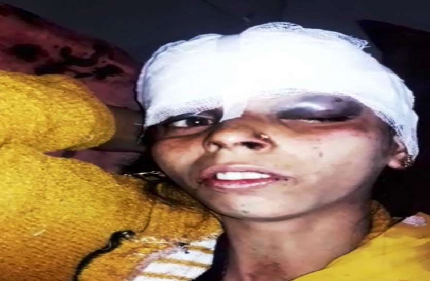 Hospital शराब के नशे में पति ने पत्नी को लाठी, डंडों से जमकर पीटा, देखें वीडियो