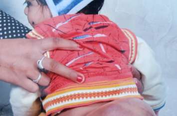 Khandwa Special Child News मासूम चेतन की पीठ में भी सिर, देखकर हैरत में पड़ गए लोग
