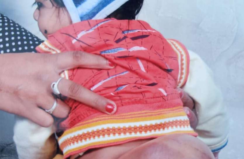 Khandwa Special Child News मासूम चेतन की पीठ में भी सिर, देखकर हैरत में पड़ गए लोग