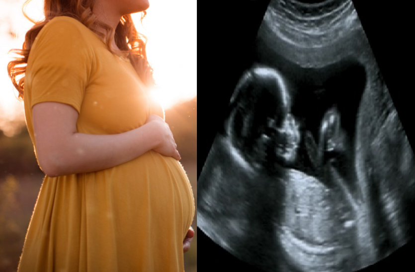 pregnant lady महिला 8 हफ्तों से थी प्रेग्नेंट, फिर अल्ट्रासाउंड करने के बाद सामने आ गई ये बुरी खबर