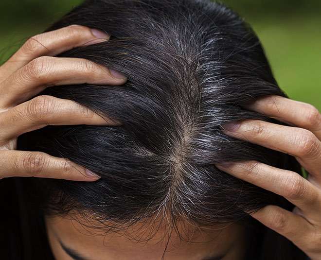 Causes And Ways To Reduce White Hair Naturally