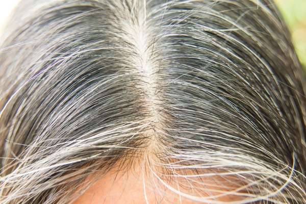 Causes And Ways To Reduce White Hair Naturally | जानिए क्यों बिना उम्र के  सफेद हो जाते हैं बाल, ये हैं सफेद होने से बचाने के उपाय | Patrika News