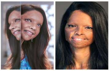 Bollywood Film Chhapaak trailor is out is based on Laxmi Aagrwal इस सच्ची घटना पर आधारित है फिल्म छपाक, लक्ष्मी अग्रवाल की जिंदगी की ये10 बड़ी बातें जान हो जाएंगे हैरान
