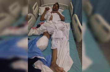 car hit to petrol pump Salesman for not giving free petrol फ्री में पेट्रोल नहीं भरा तो सफारी कार सवार दबंग ने सेल्समैन को रौंदा, काटना पड़ा एक पैर