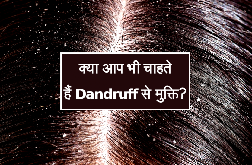 health news क्या आप भी चाहते हैं सर्दियों में Dandruff से मुक्ति? तो आजमाएं ये घरेलू Tips