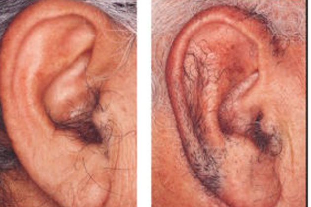 hair on ears means in astrology | अगर आपके कान में हैं बाल, तो आप सबसे  ज्यादा भाग्यशाली, जानिए ये गुप्त बातें | Patrika News