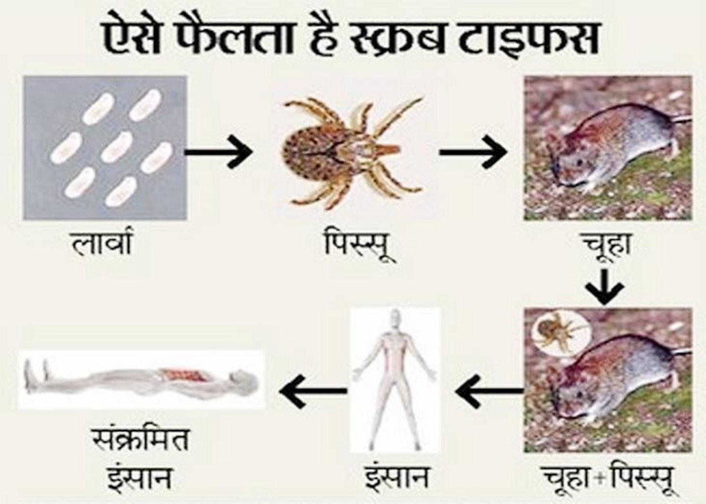 Scrub typhus bacteria attack in 10 districts including Satna | सतना ...