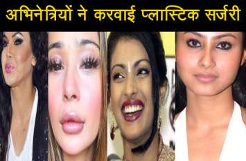 plastic surgeries of bollywood actresses video इन अभिनेत्रियों ने प्लास्टिक सर्जरी करवाकर बिगाड़ा चेहरा, देखें वीडियो