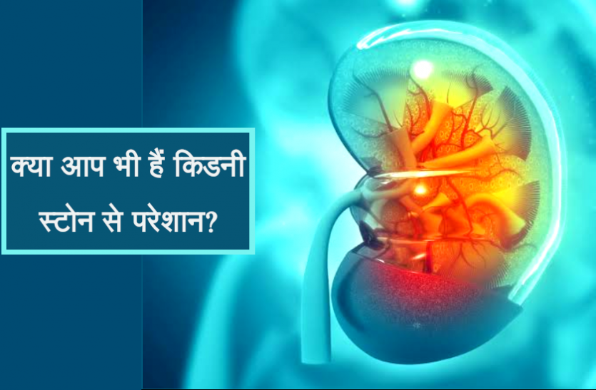health news किडनी स्टोन के दर्द से हैं परेशान, तो आज ही बदल दें अपनी ये आदतें