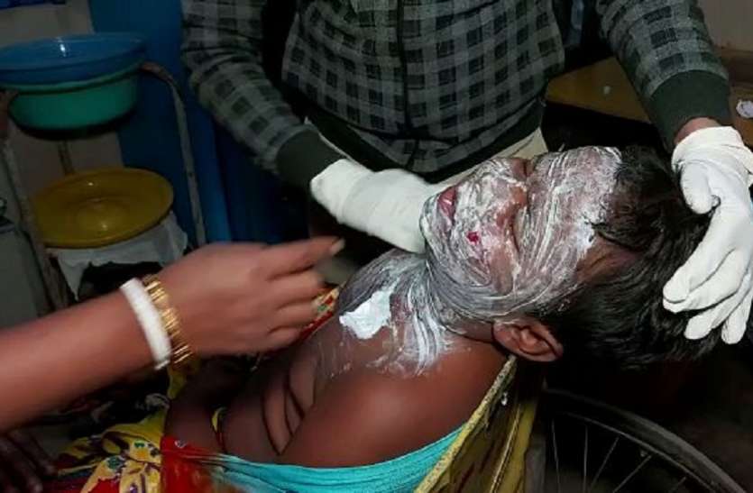 रास्ते में पड़े बम से खेलने लगे बच्चे, तीन घायल रास्ते में पड़े बम से खेलने लगे बच्चे, तीन घायल