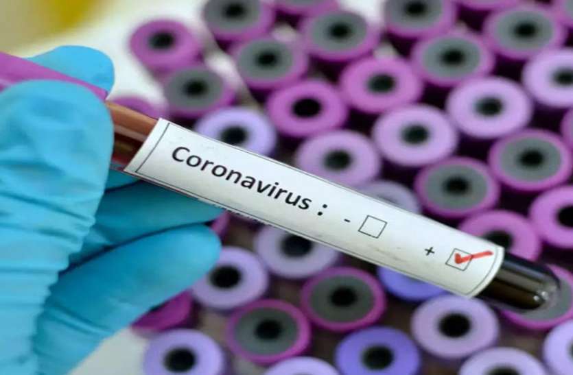 corana.jpg कोरोना से टूट रही सांसों की डोर, तीन पॉजीटिव की मौत, 32 नए कोरोना मरीज