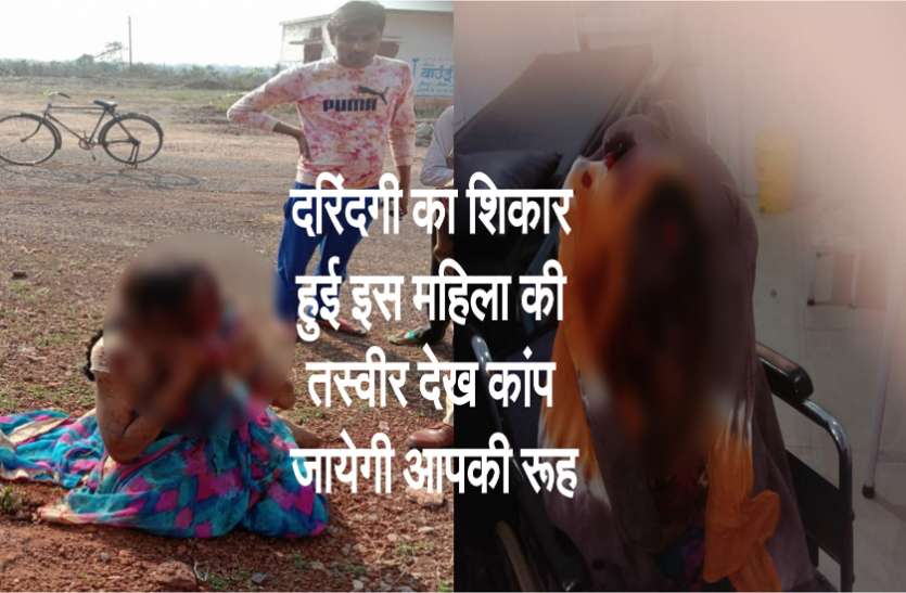 राजधानी में हुए तेजाबी हमले में 80 प्रतिशत झुलसा चेहरा, महिला की चीख-पुकार से सिहर उठे लोग, दुष्कर्म की भी आशंका छपाक से पहचान ले गया: राजधानी में हुआ तेज़ाब से हमला, 80 प्रतिशत झुलसी महिला की चीखों से सिहर उठे लोग