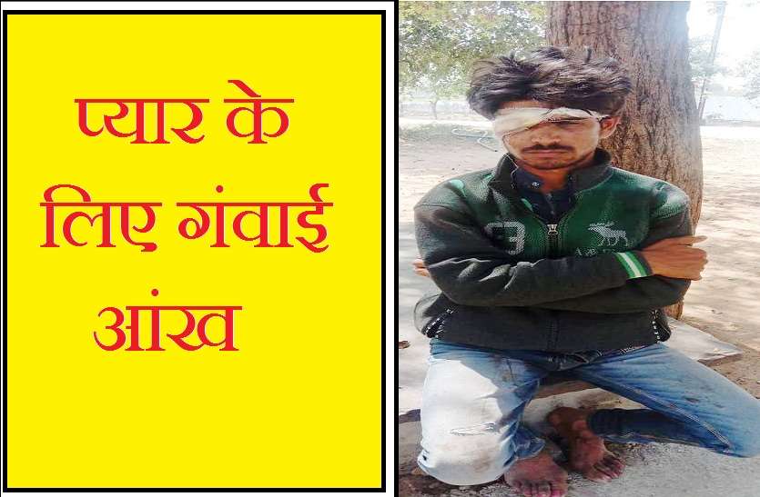 lethal attack on newly married couple in shivpuri एक आंख देकर चुकानी पड़ी लव मैरिज करने कीमत, लडक़ी के घरवालों ने किया जानलेवा हमला
