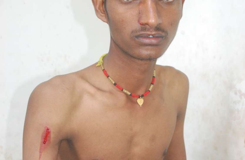 Leopard attacked young man who left water in wheat field, injured by claw गेहूं के खेत में पानी छोडऩे गए युवक पर तेंदुए ने किया हमला, पंजा लगने से घायल