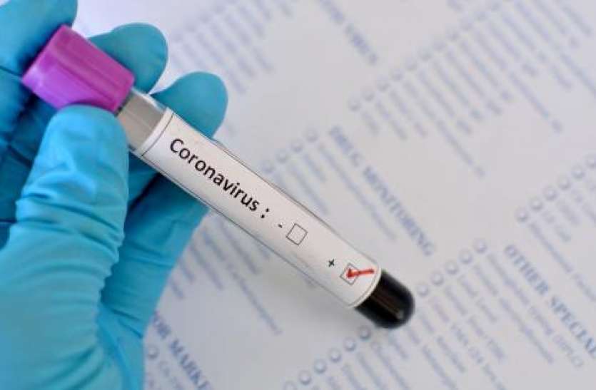 coronavirus_test.jpg कोराना से बचाव के इंतजाम करने मजदूर कांग्रेस ने महाप्रबंधक को सौंपा