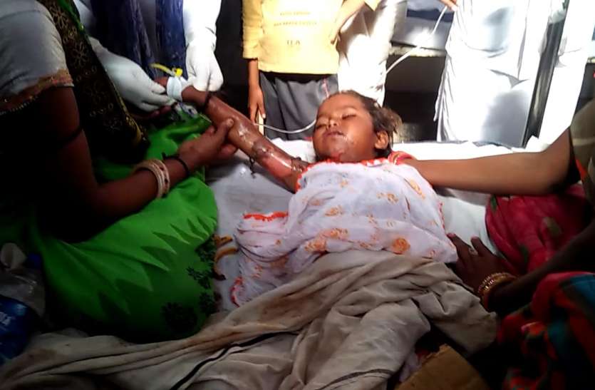 आग से झुलसी मासूम, अस्पताल में नहीं मिले डॉक्टर आग से झुलसी मासूम, अस्पताल में नहीं मिले डॉक्टर