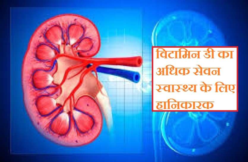 विटामिन डी की अधिक मात्रा शरीर में बढ़ाती है कैल्शियम का स्तर, गुर्दे हो सकते हैं प्रभावित विटामिन डी की अधिक मात्रा शरीर में बढ़ाती है कैल्शियम का स्तर, गुर्दे हो सकते हैं प्रभावित