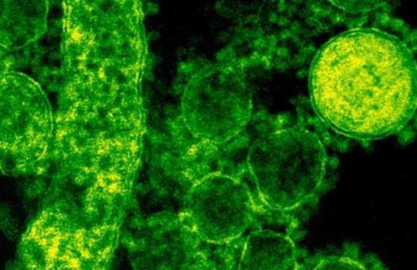 mers_coronavirus.jpg